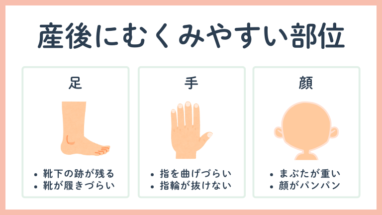 産後にむくみやすい部位
