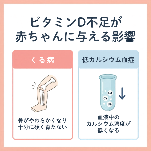 妊娠中のビタミンD不足による赤ちゃんへの影響